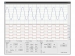 Oscilloscoop en Logic Analyzer Shield voor Raspberry Pi